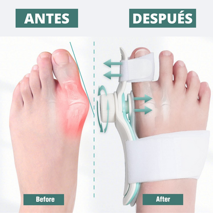 CORRECTOR DE JUANETE