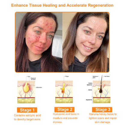 CREMA POTENTE PARA TODO EL CUERPO BEE VENOM