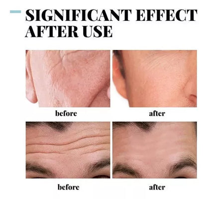 GRATIS 1 UNIDAD 😱 PROMO 2 X 1 🎁 -50%COLAGENO HIDROLIZADO ANTI-ARRUGAS