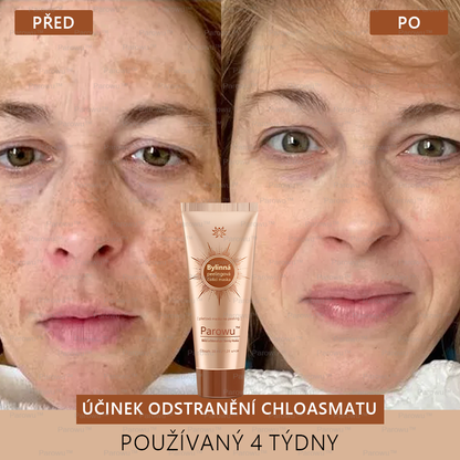 MÁSCARA DESPÍDETE DE LAS MANCHAS - PARAWO