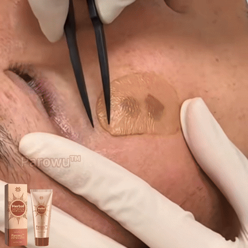 MÁSCARA DESPÍDETE DE LAS MANCHAS - PARAWO