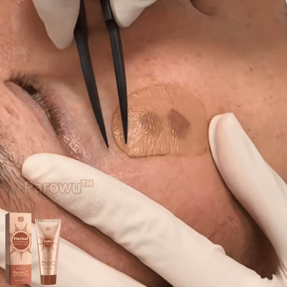 MÁSCARA DESPÍDETE DE LAS MANCHAS - PARAWO