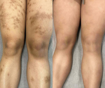 MÁSCARA DESPÍDETE DE LAS MANCHAS - PARAWO