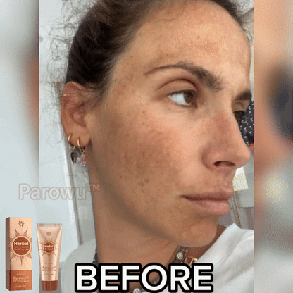 MÁSCARA DESPÍDETE DE LAS MANCHAS - PARAWO