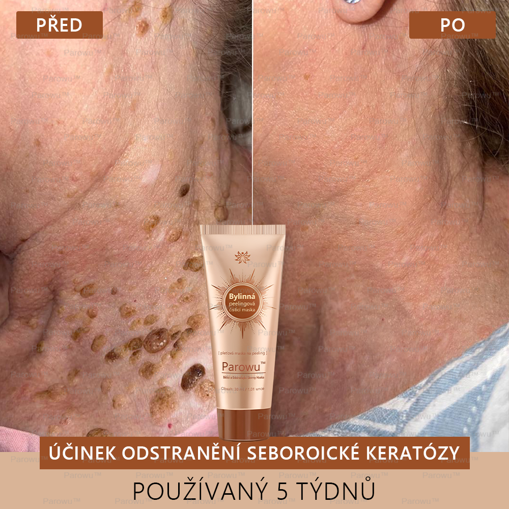 MÁSCARA DESPÍDETE DE LAS MANCHAS - PARAWO