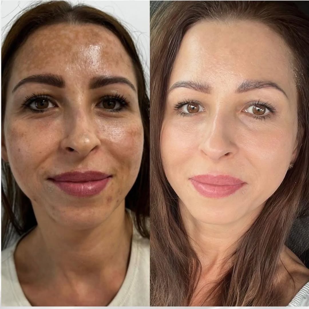 MÁSCARA DESPÍDETE DE LAS MANCHAS - PARAWO