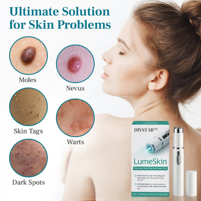 LÁPIZ LÁSER PARA ELIMINAR VERRUGAS Y LUNARES